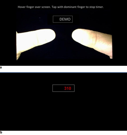 The touchscreen device is oriented in landscape position and the thumbs are displayed on the screen at the beginning of the test. (B) the reaction times are displayed on a rectangular box in the upper middle part of the screen